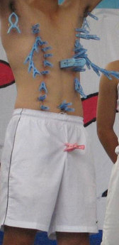 �i����j